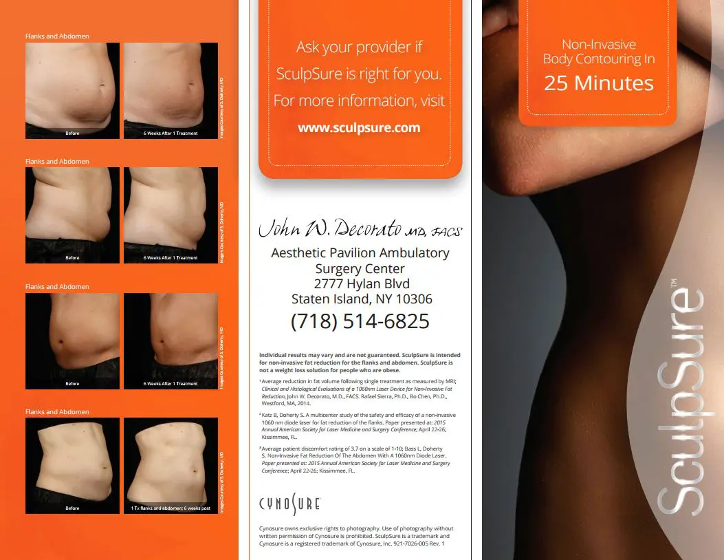 SculpSure Before and After Pictures Staten Island, NY